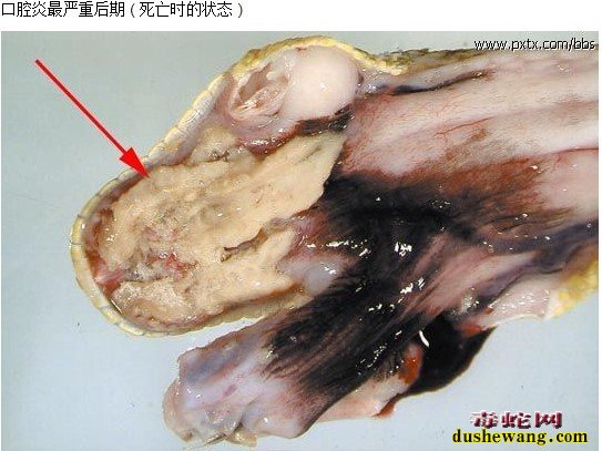 蟒蛇口腔炎怎么预防治疗?