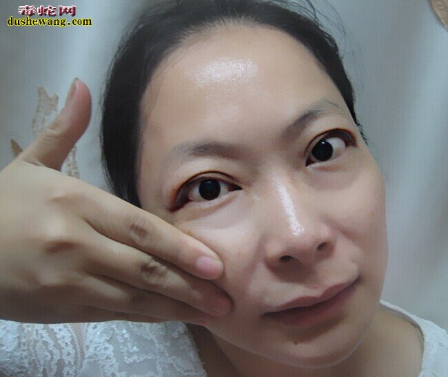 蛇毒面膜,蛇毒面膜怎么样