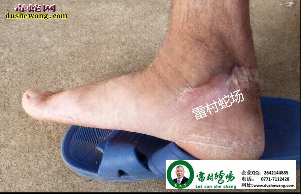 雷村蛇场