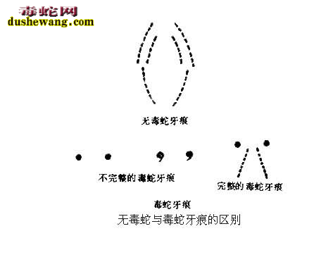 被蛇咬伤症状