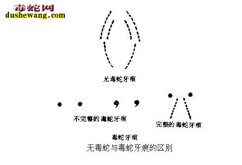 毒蛇咬伤的鉴别诊断