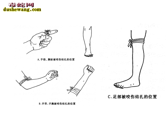 【毒蛇咬伤紧急处理】如何处理毒蛇咬伤与急救措施