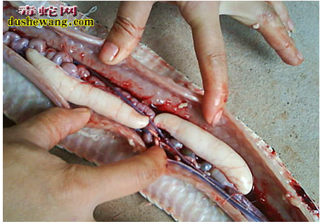 蛇脾脏病