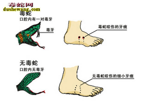 毒蛇和无毒蛇咬伤区别图解1