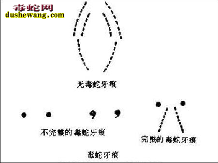 毒蛇和无毒蛇咬伤区别图解2