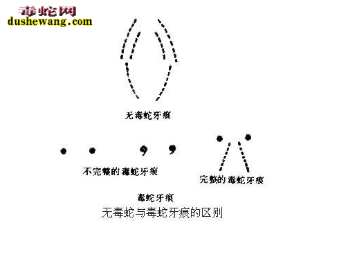 无毒蛇咬伤症状