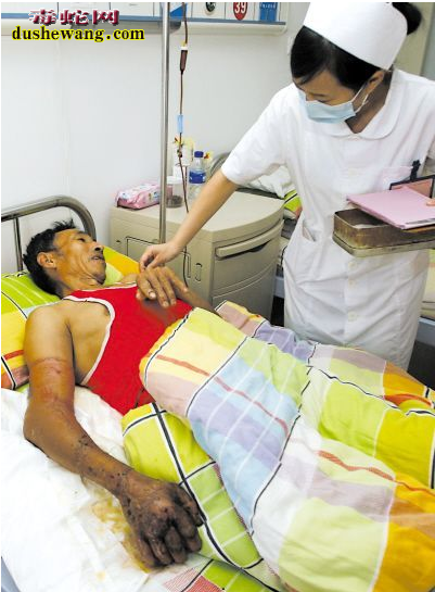 盛夏毒蛇伤人频发衡南男子被毒蛇咬伤险送命