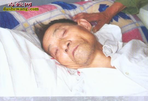 被毒蛇咬伤症状