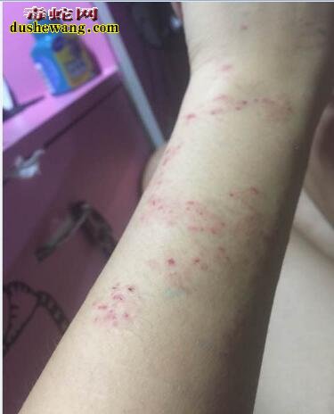 赤链蛇到底有没有毒