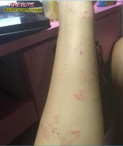 赤链蛇到底有没有毒