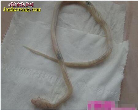 蛇肠胃炎治疗药物