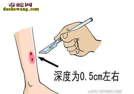 被毒蛇咬伤有什么危害?