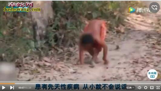 15岁男孩被遗弃与狗长大 走路四肢着地像狗行走!