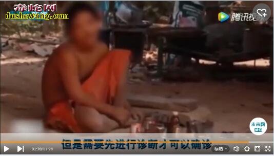 15岁男孩被遗弃与狗长大 走路四肢着地像狗行走!