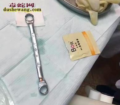 男子下体被扳手套住17小时