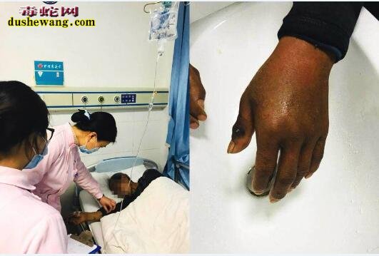 春季毒蛇出蛰 湖南农民抓蛇遇眼镜蛇咬伤先丧命!