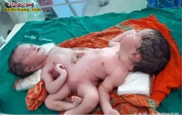 孕妇产婴儿不敢直视!医生让扔掉!