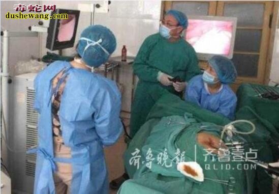 山东聊城大叔15厘米黄瓜卡直肠是怎么回事?