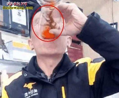 又是直播!男子直播生吞49条活泥鳅 胃部崩溃直接送医院!