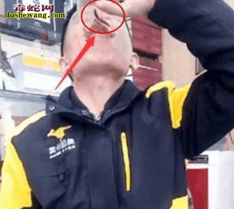 又是直播!男子直播生吞49条活泥鳅 胃部崩溃直接送医院!