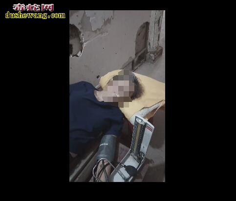 首列养蛇人对眼镜蛇粪便过敏案例报道,养蛇人要提高警惕!