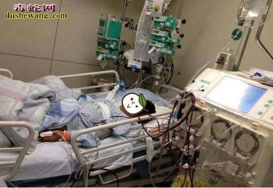 深圳蛇伤医院：深圳市中医院-13岁男孩蝰蛇咬伤治疗