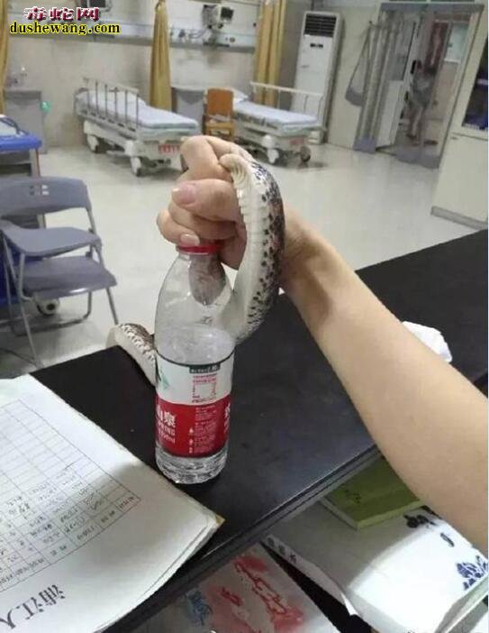 23岁姑娘被蛇咬后徒手握蛇急诊，赤练蛇真的是无毒吗？