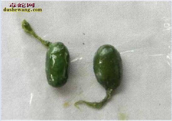新鲜蛇胆图片,了解一下蛇胆是什么样子的?