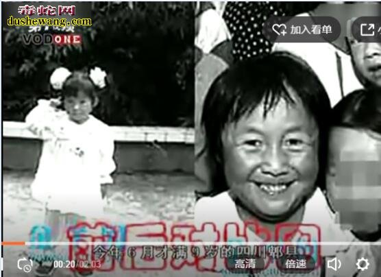蛇胆虽好不能乱吃!9岁小女孩吃8个蛇胆变“老太婆”