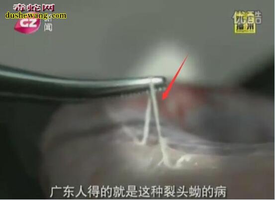 看看这蛇寄生虫还敢吃野生蛇吗?专家推荐吃养殖蛇!