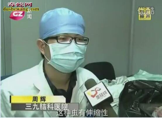 看看这蛇寄生虫还敢吃野生蛇吗?专家推荐吃养殖蛇!