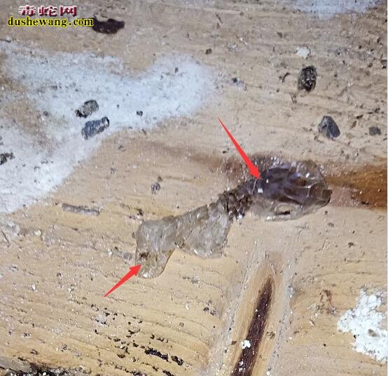 看粪便识蛇病:水漾稀粪便是肠炎吗?