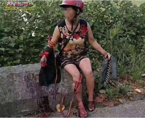 脚被蛇咬到了怎么办?