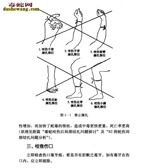 陈远辉作品蛇伤精治