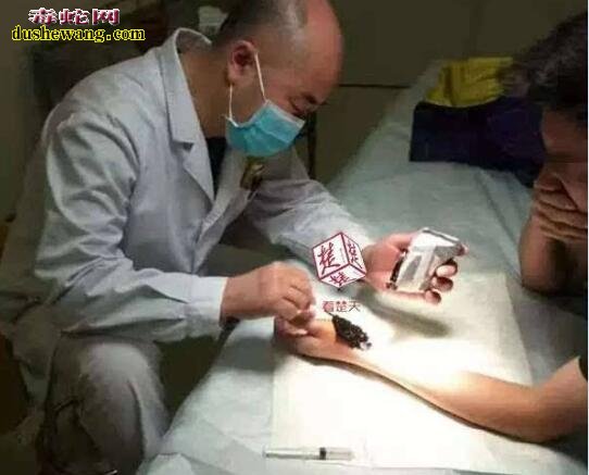 被蜈蚣咬了怎么办?