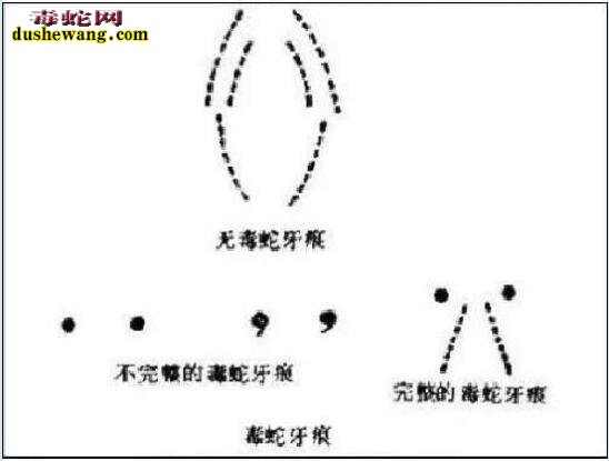 一般蛇咬的伤口牙痕图片大全,看看毒蛇和无毒蛇咬伤不同的伤痕!