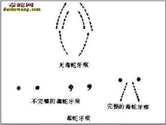 一般蛇咬的伤口牙痕图片大全，看看毒蛇和无毒蛇咬伤不同的伤痕！