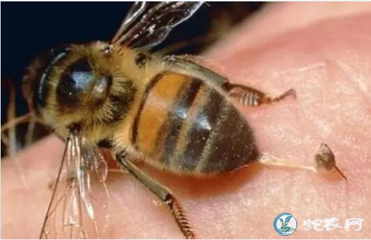 被蜜蜂蛰了怎么处理？什么方法消肿简单效果好？