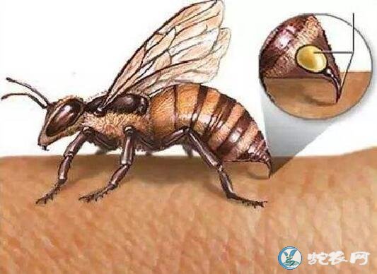 被蜜蜂蛰了怎么处理？什么方法消肿简单效果好？