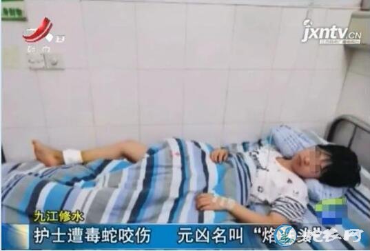 九江护士上晚班被烙铁头蛇咬伤!伤口已经出现坏死!