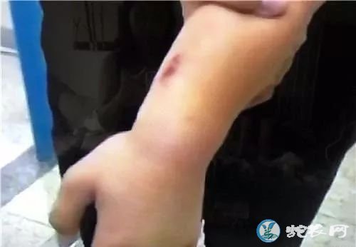 沈阳14岁男孩被自己养的毒蛇咬伤!中国十大毒蛇之一的竹叶青蛇!
