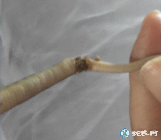 图说养蛇:蛇苗没开口就有肠炎的原因分析!