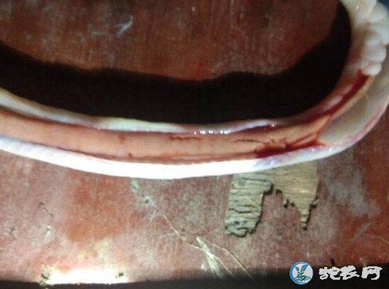 图说养蛇:一蛇友养蛇场爆发109号病解剖分析