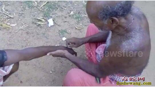 印度男子被蛇咬后找“法师”刀割治疗