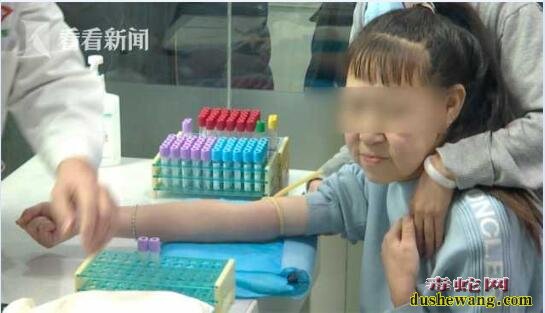 15岁少女长了60岁的脸怎么回事?专家给出答案!