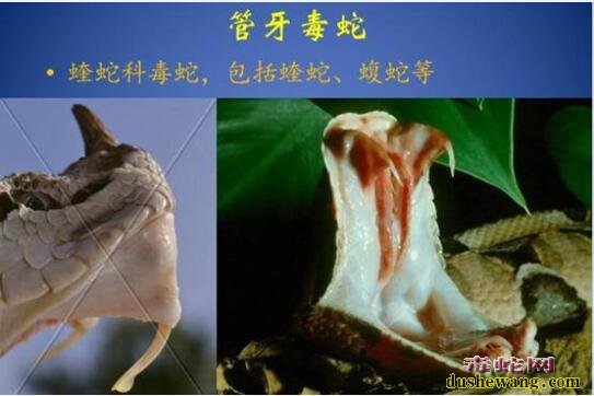 被蛇咬多久发作?毒蛇咬伤发作时间和品种、咬伤部位关系大!