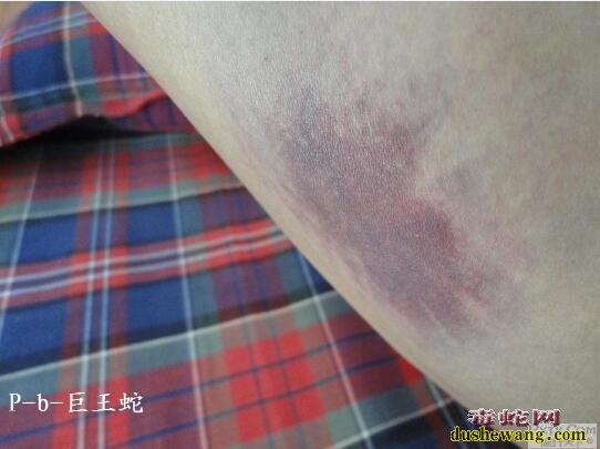 虎斑游蛇毒性多强?图片为证!