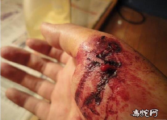 虎斑颈槽蛇毒性?能咬死人吗?