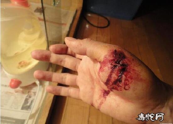 梦见自己被蛇咬流很多血是什么意思?