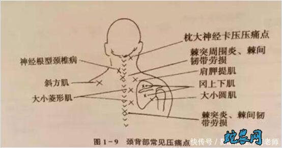【河北文化习俗】石家庄民俗文化-中医络病诊疗方法!